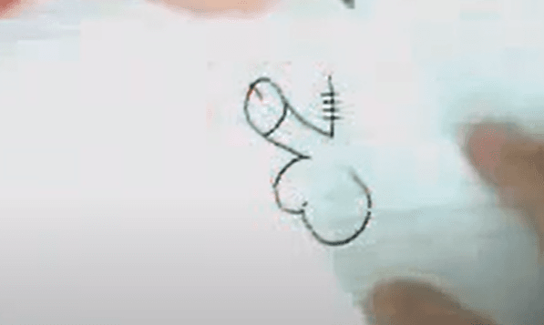 Imagen de algo que parece unos órganos sexuales másculinos